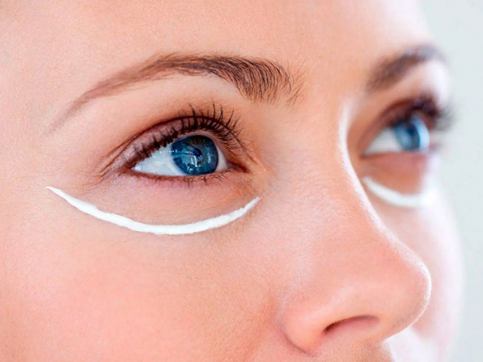 Göz çevresi yaşlanması nasıl önlenebilir?