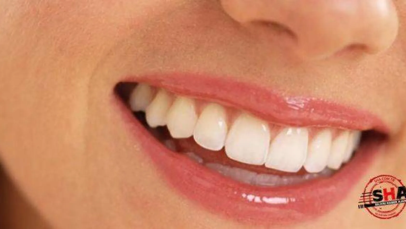 Diş beyazlatma ile sararan dişlere son