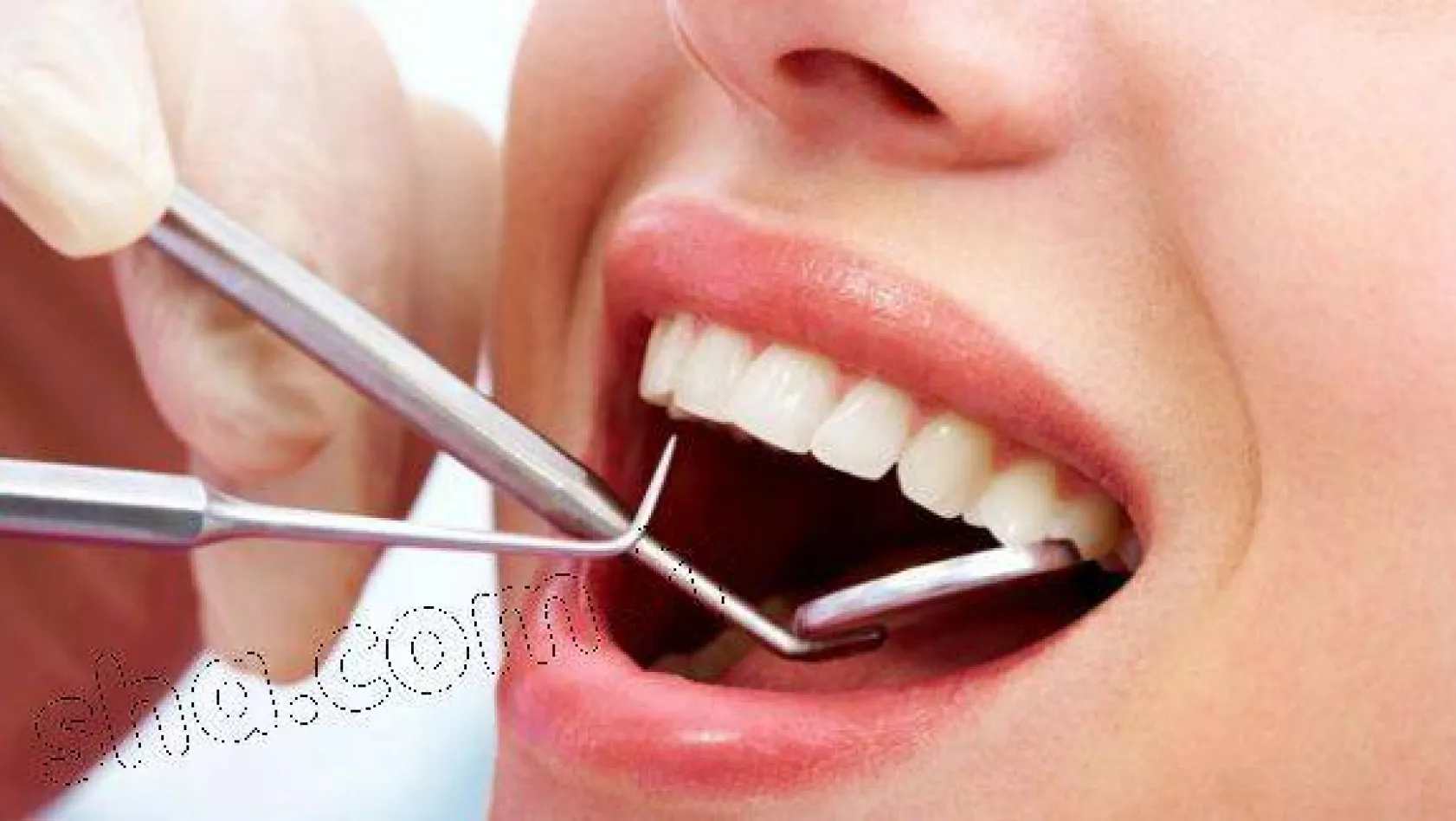 Şeker hastalarında diş sağlığına dikkat