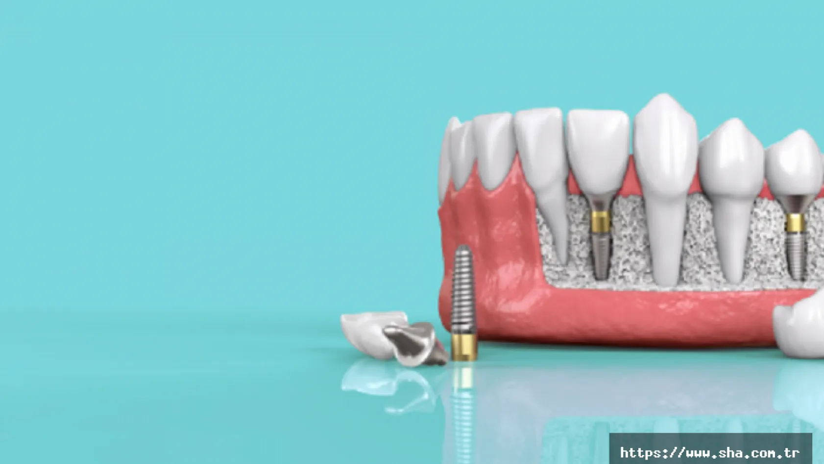 Ağız ve Diş Sağlığının Markası Türkiye İmplant Diş