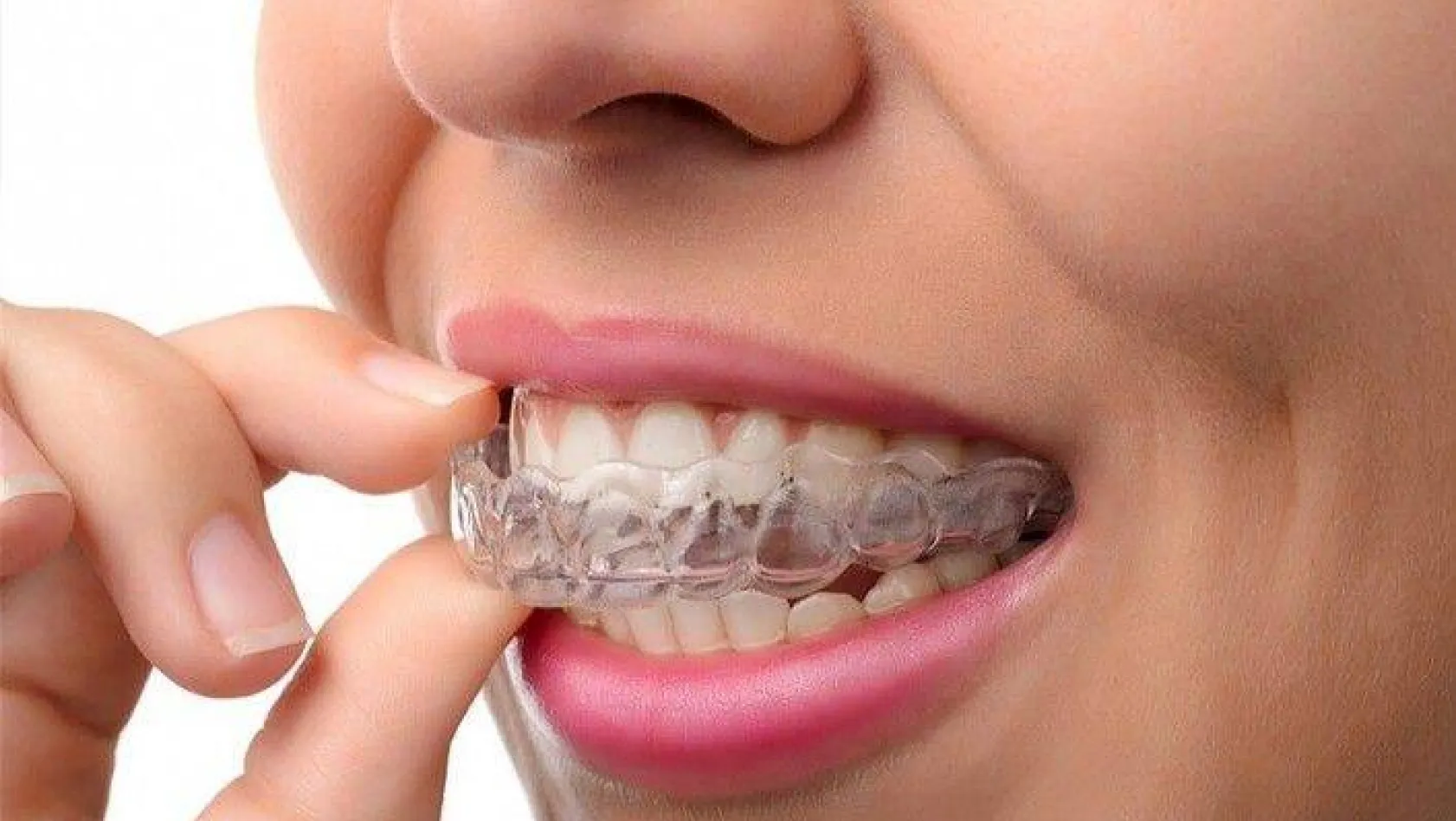 Son yıllarda çok sık rastlanan diş gıcırdatma sorunu