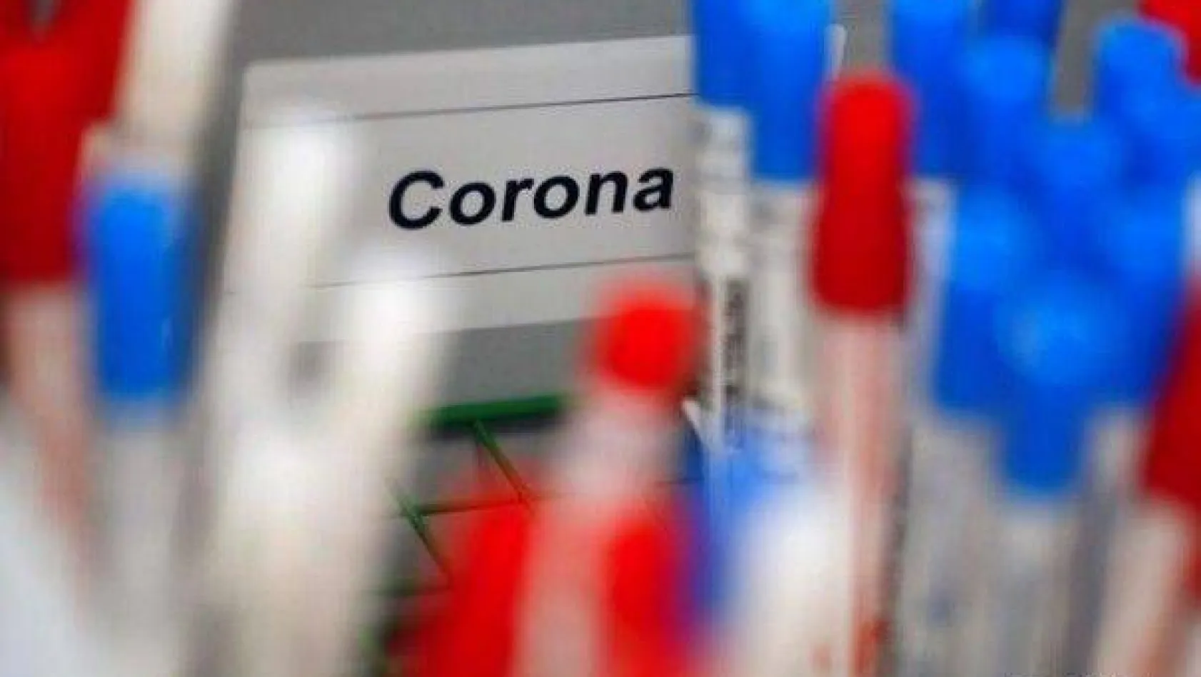 Beş farklı sigorta şirketi,  Koronavirüs tedavisini kapsamına aldı