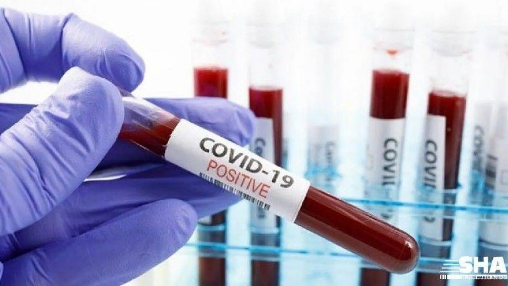 Üşüttüm diyene koronavirüs testi