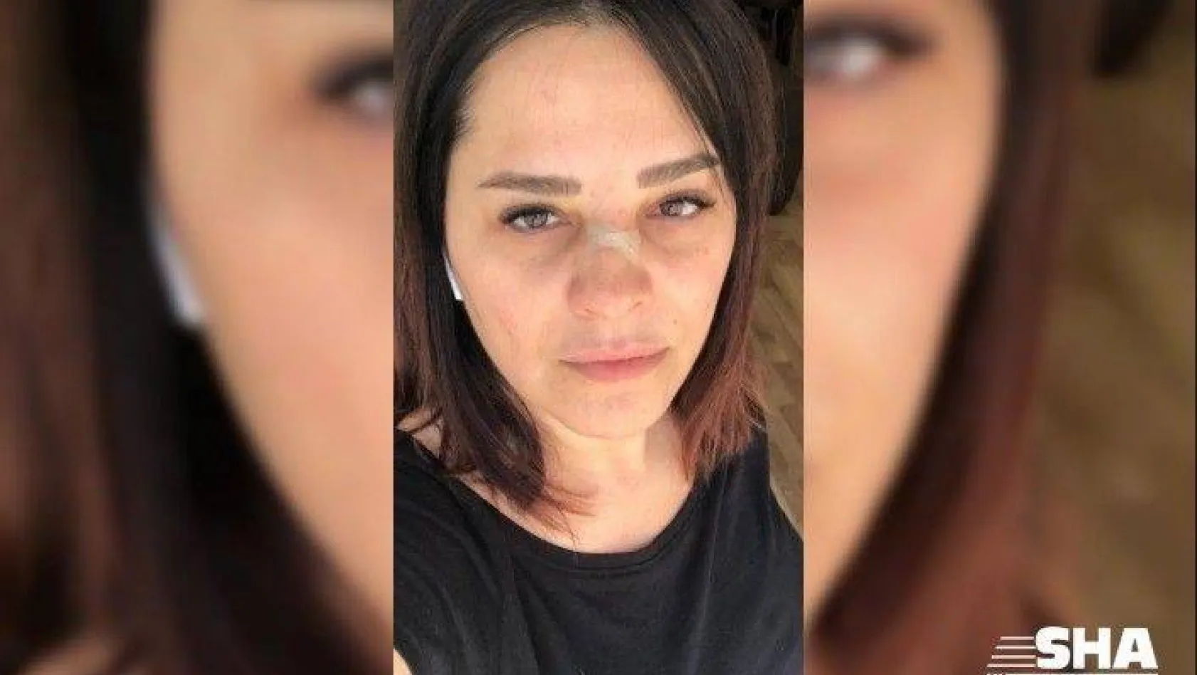 Ünlü şarkıcı Reyhan Karaca'nın burnu kırıldı