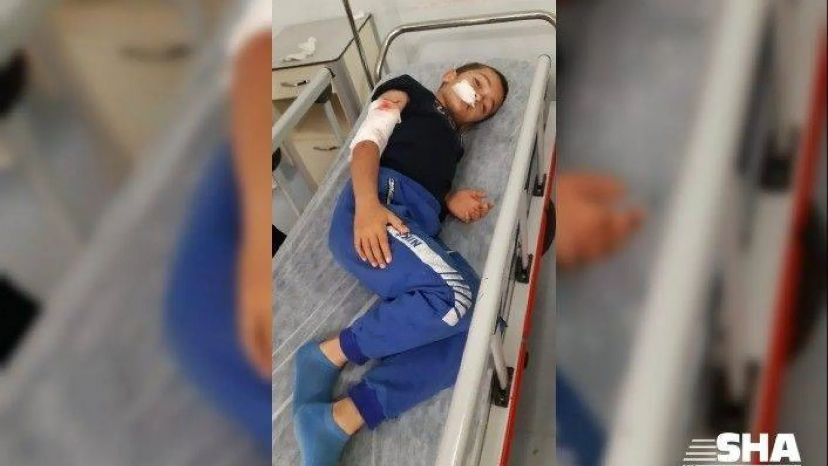 Sultangazi'de 10 yaşındaki çocuğa köpek saldırdı