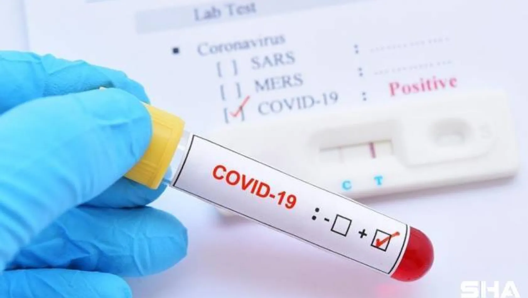 Koronavirüs salgınında vaka sayısı 108 milyon oldu