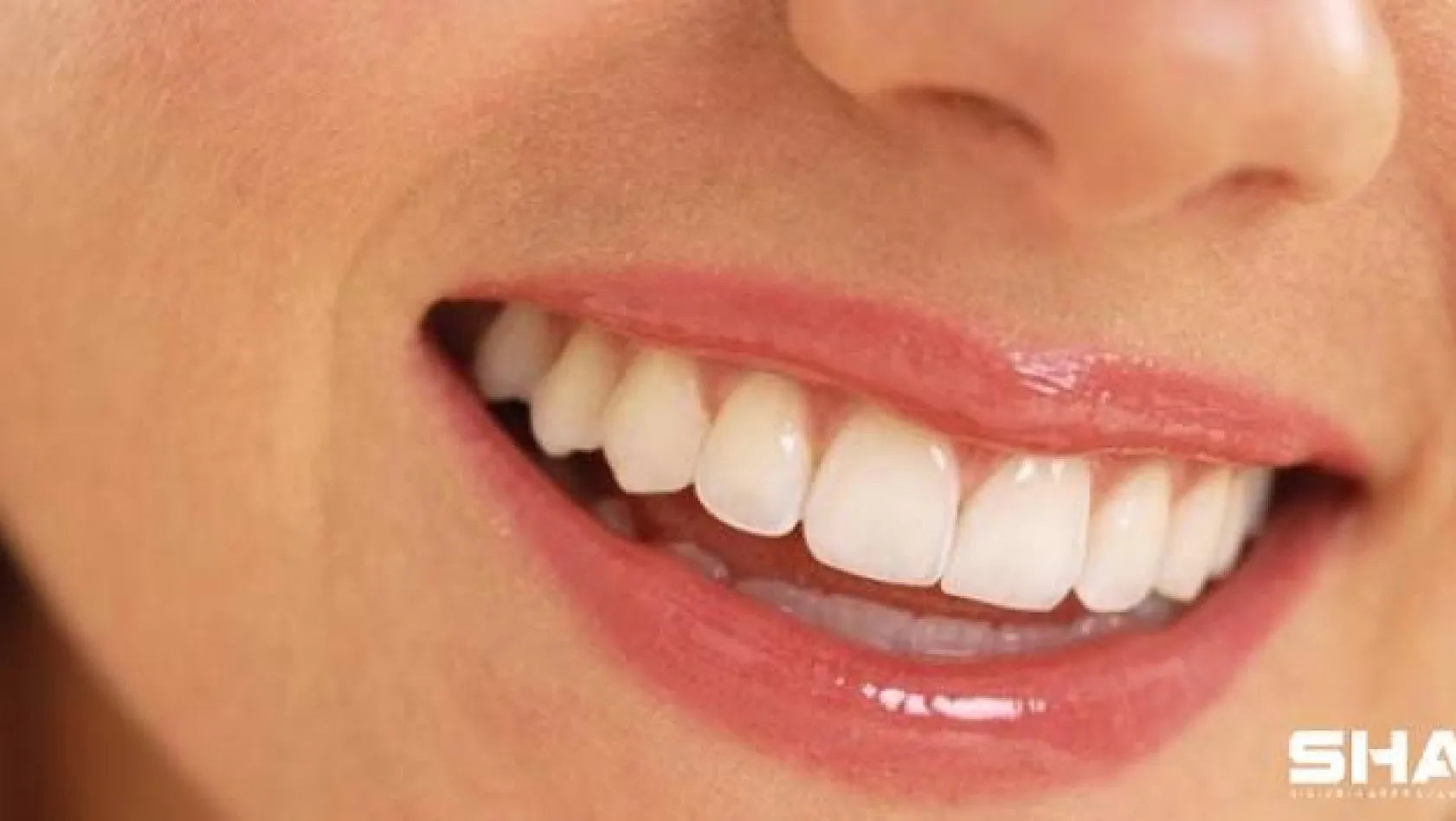 Dişlerinizdeki 'gümüş dolgular' ne kadar güvenilir