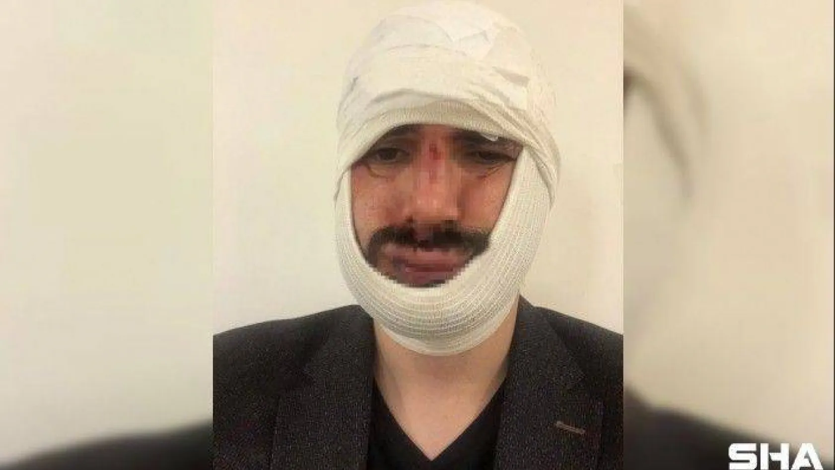 Anadolu Ajansı muhabirini darp eden saldırganlar tutuklandı