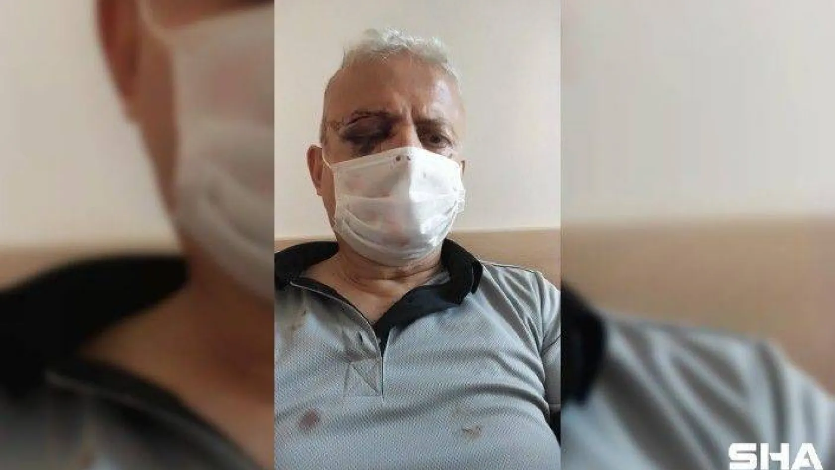Maske uyarısında bulunduğu şahıs tarafından darp edilen güvenlik görevlisi görme yetisini kaybetti