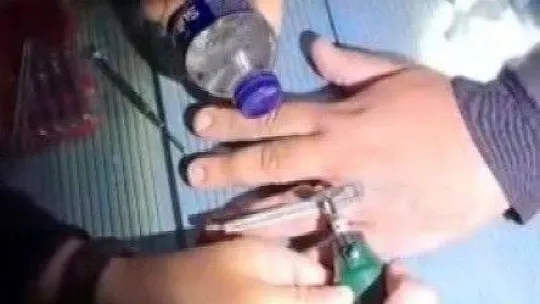 17 yıldır taktığı evlilik yüzüğü, itfaiye operasyonu ile çıkarıldı