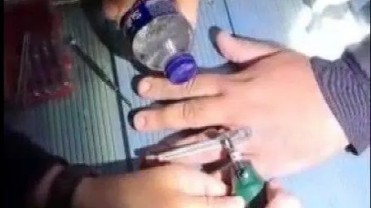 17 yıldır taktığı evlilik yüzüğü, itfaiye operasyonu ile çıkarıldı