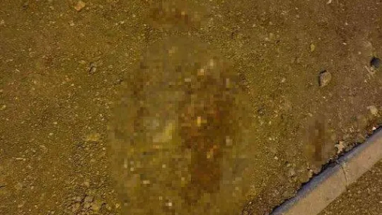 Ankara'da feci kaza: Otomobilin çarptığı genç kız hayatını kaybetti