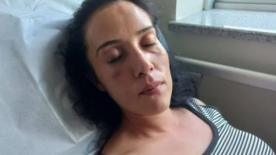 Ayrı yaşadığı eşini eve kilitleyerek işkence eden cani koca tutuklandı