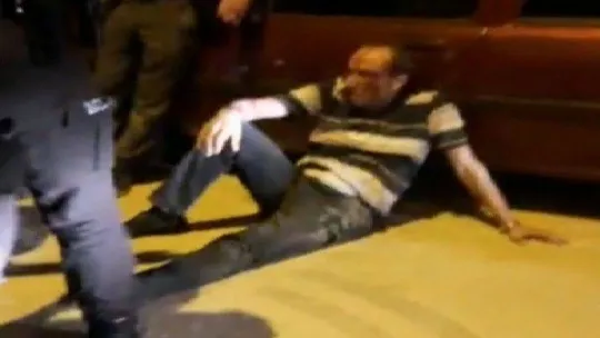 Bandırma'da ticari taksi, kavgada yaralanan kişinin kolunu böyle ezdi