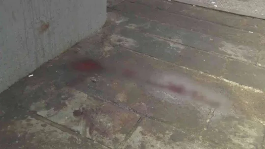 Başkentte bıçaklı saldırıya uğrayan dolmuş şoförü hayatını kaybetti