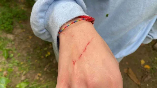 Beşiktaş'ta ilginç olay: Kedisini kurtarmak isterken ağaçta mahsur kaldı