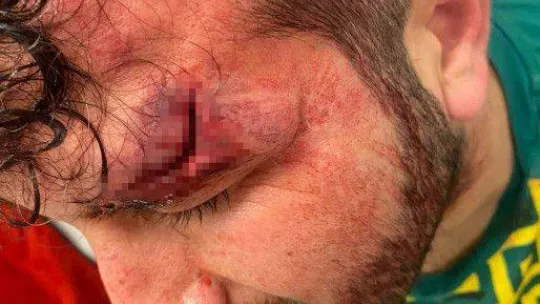 Beykoz'da amatör lig maçında kavga: Tekmeler yumruklar havada uçuştu