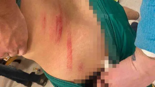 Beykoz'da amatör lig maçında kavga: Tekmeler yumruklar havada uçuştu