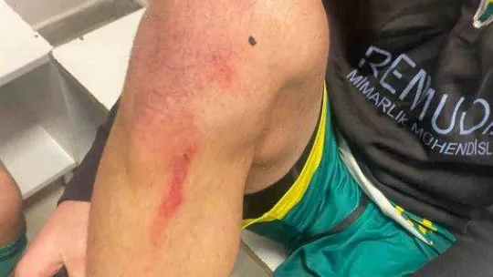 Beykoz'da amatör lig maçında kavga: Tekmeler yumruklar havada uçuştu