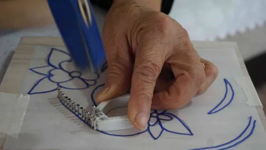 Böbrekleri yüzde 6 çalışan kadının hastalığına hobileri ilaç oldu