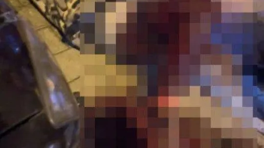 Bursa'da sözlü tartışma silahlı kavgaya dönüştü: 1 ağır yaralı