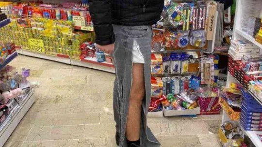 Çankaya'da başıboş köpekler vatandaşın kıyafetlerini parçaladı