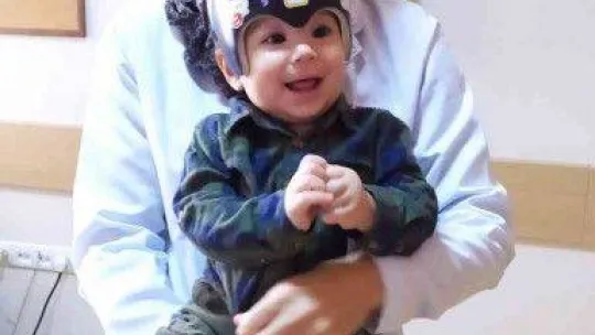 Çocuklarda kafatası şekil bozukluğunda dikkat çeken artış