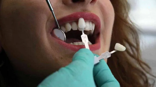 Diş beyazlatayım derken sağlığınızdan olmayın