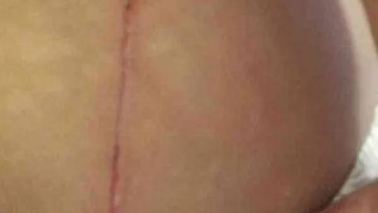 Dövme yaptırmak için gitti, darp edilip vücudu bıçakla çizildi