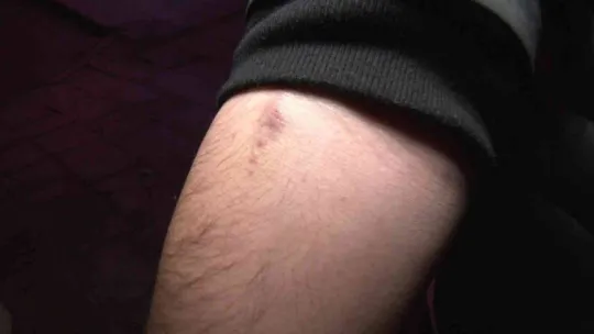 Esenyurt'ta skandal iddia: Özel tıp merkezinde çalışan doktor, hastasını morfin bağımlısı haline getirip 700 bin TL'sini aldı