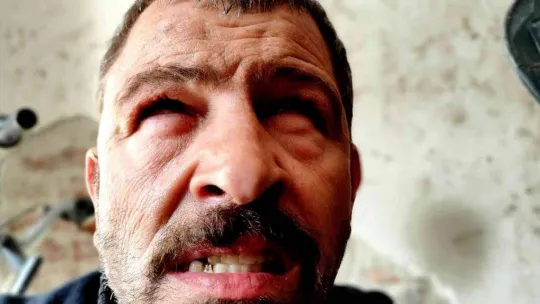 Gözleri görmüyor, hissederek 20 yıldır motosiklet tamir ediyor