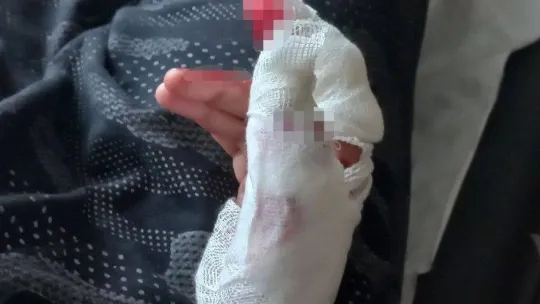 Gözü dönen koca eşini feci şekilde darp edip, bıçakla parmağını kesmeye çalıştı