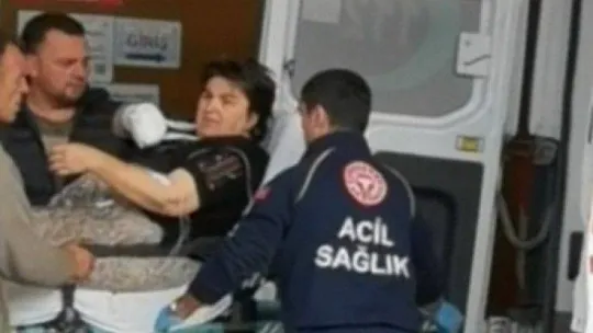 Hızarın üzerine düşen kadının kolu koptu