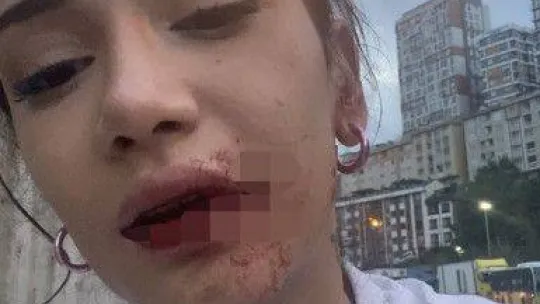 İstanbul'da kız kardeşler sokak ortasında dehşeti yaşadı: Önce darp sonra gasp edildiler