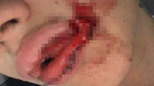 İstanbul'da kız kardeşler sokak ortasında dehşeti yaşadı: Önce darp sonra gasp edildiler