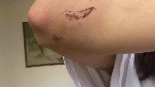 İstanbul'da kız kardeşler sokak ortasında dehşeti yaşadı: Önce darp sonra gasp edildiler