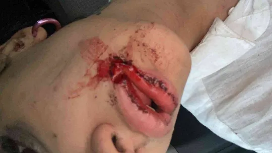 İstanbul'da kız kardeşlere dehşeti yaşatan saldırgan tutuklandı