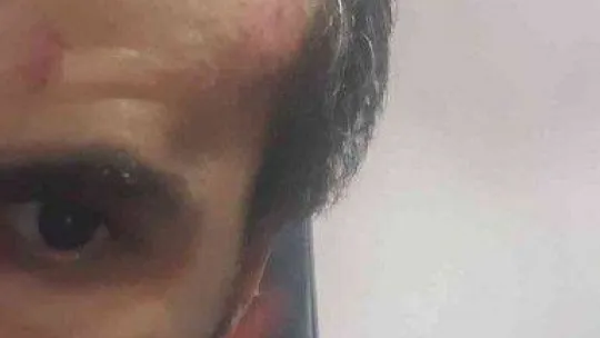 Silivri'de uçan tekme dehşeti kamerada: Evine giderken saldırıya uğradı