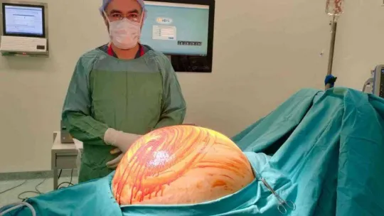 Karnından 35 kilogramlık kitle çıktı