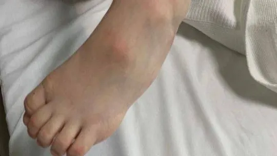 Kazak kardeşler Nuray ve Bota Türkiye'de şifa buldu