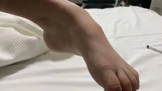 Kazak kardeşler Nuray ve Bota Türkiye'de şifa buldu