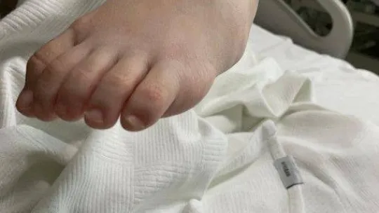 Kazak kardeşler Nuray ve Bota Türkiye'de şifa buldu