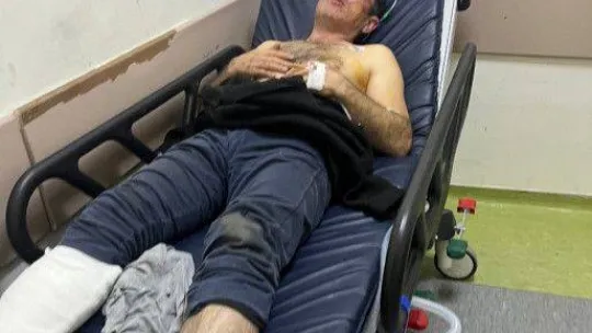 Kendi galerilerinin önünde ölesiye darp edildiler