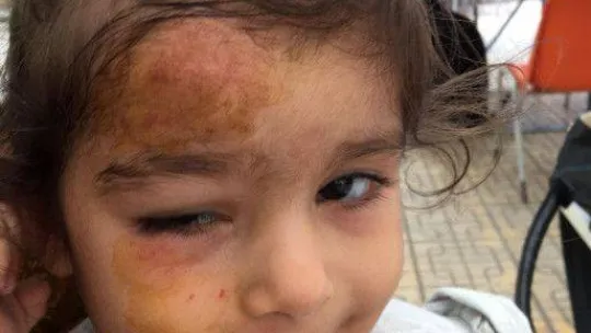 Kreşte 33 aylık çocuğun tehlike atlattığı anlar