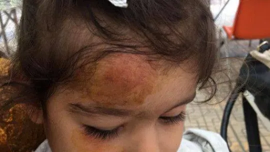 Kreşte 33 aylık çocuğun tehlike atlattığı anlar