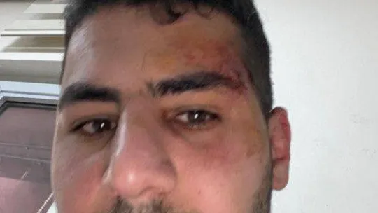 Küçükçekmece'de kafeye gelen müşteri çalışanı darp etti