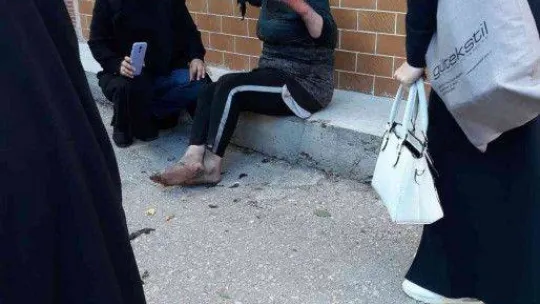 Mutfakta harlayan yağ sonucu bir kişi yanarak yaralandı