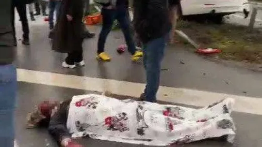 Otoyolda korkutan kaza: Bariyerlere çarpan lüks otomobil alev aldı