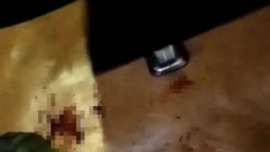 (Özel) İstanbul'da dehşet anları kamerada: Engelli genci bıçaklayıp parasını gasp ettiler