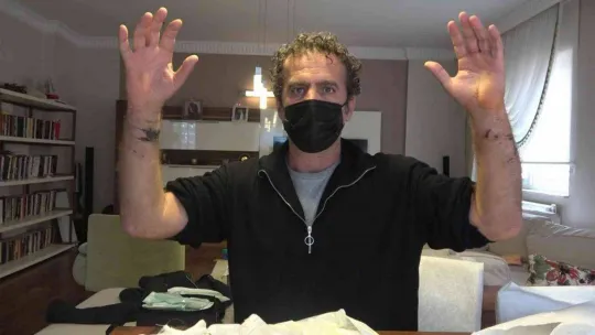 Pitbullu saldırıya uğradı...Kolları parçalandı, ölümden döndü